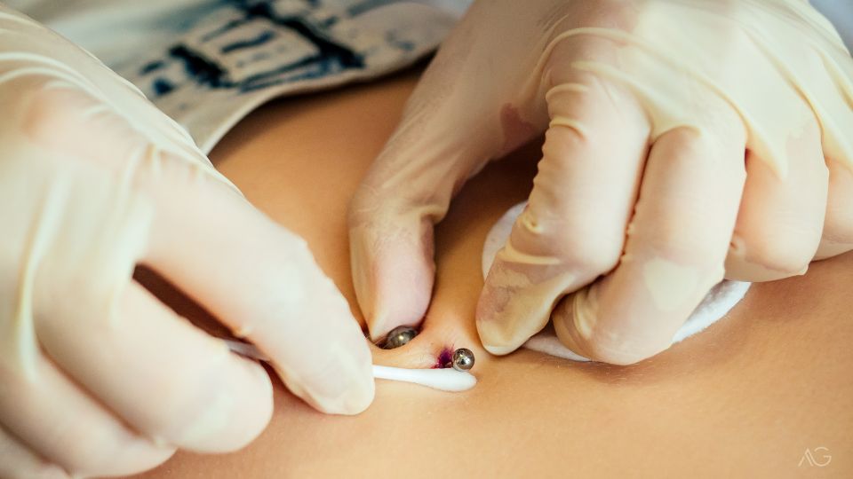 Riesgos de hacerte un piercing si tienes psoriasis Riesgos de hacerte un piercing si tienes psoriasis.