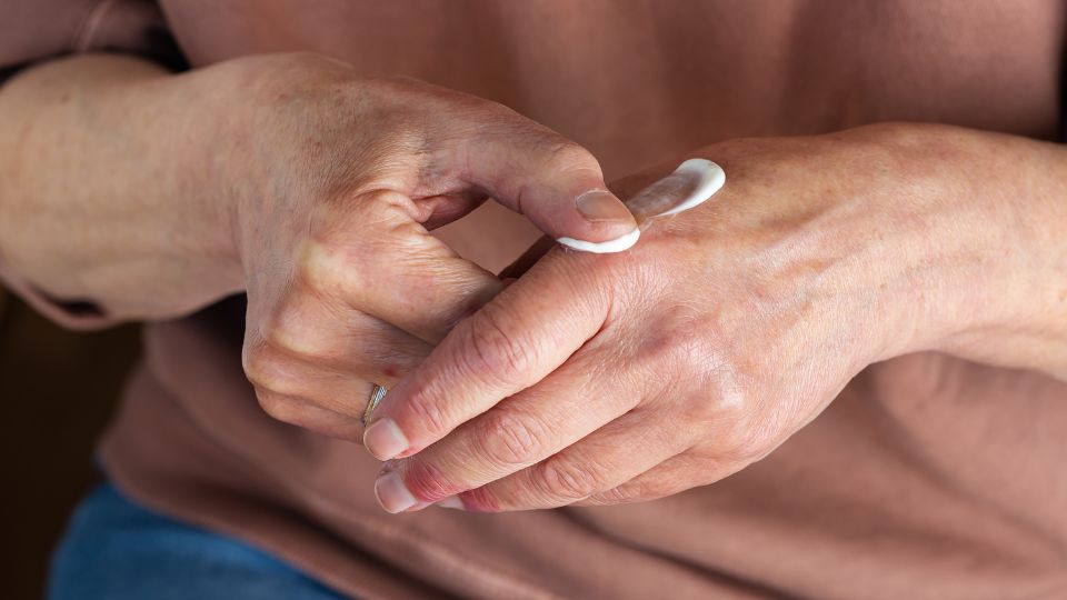 La coexistencia de psoriasis y diabetes se tiene en cuenta en los tratamientos La coexistencia de psoriasis y diabetes se tiene en cuenta en los tratamientos.