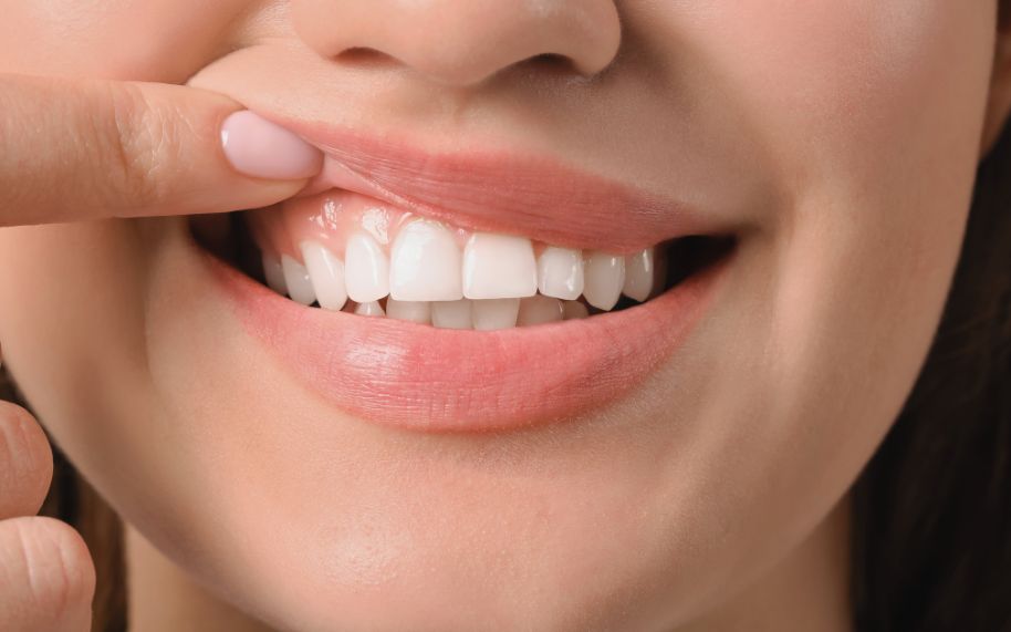 What is the relationship between gum health, psoriasis and periodontitis?