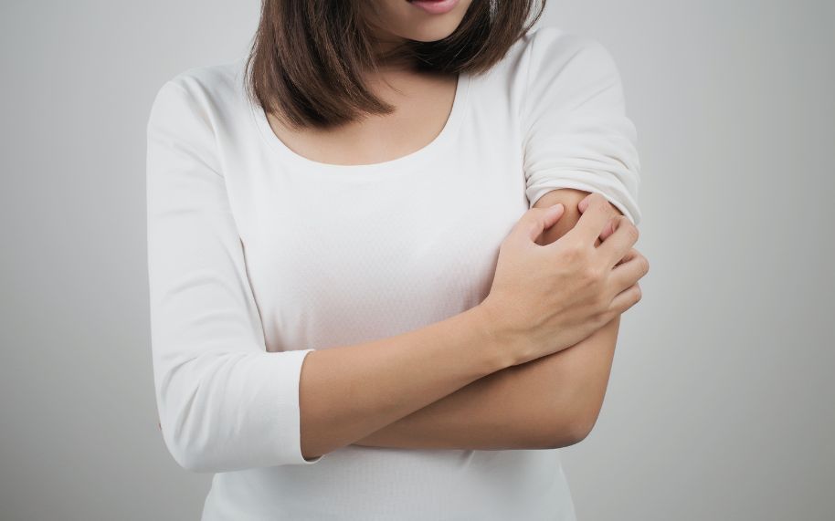 Mujer adulta con dermatitis atópica mal controlada rascándose el brazo durante un brote