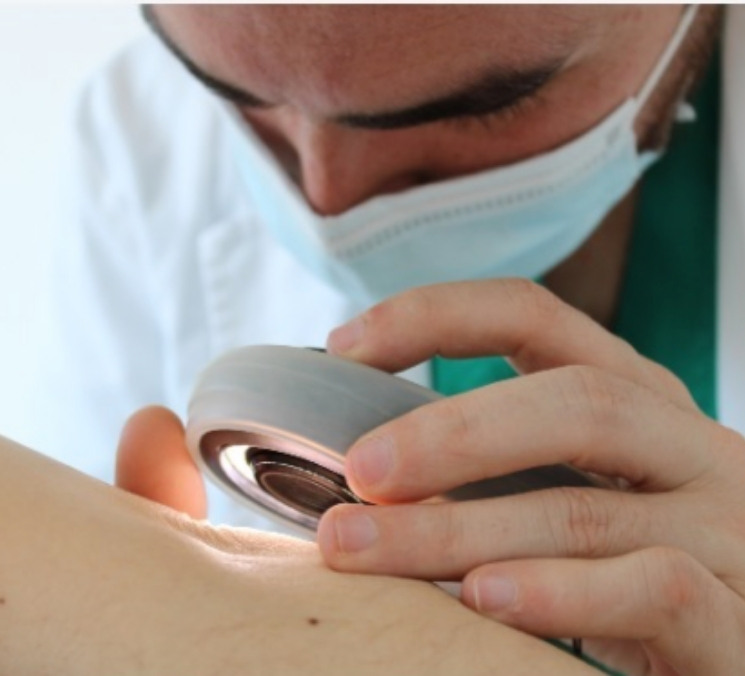 Experto en psoriasis Experto en psoriasis